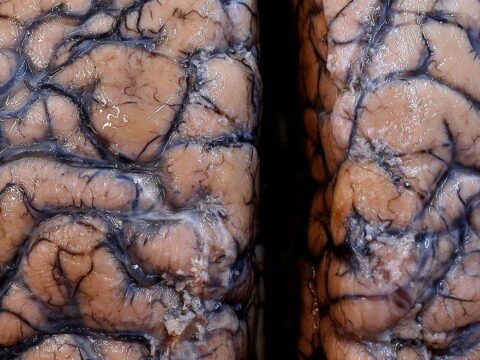 Scientists warn of potential wave of COVID-linked mind wound