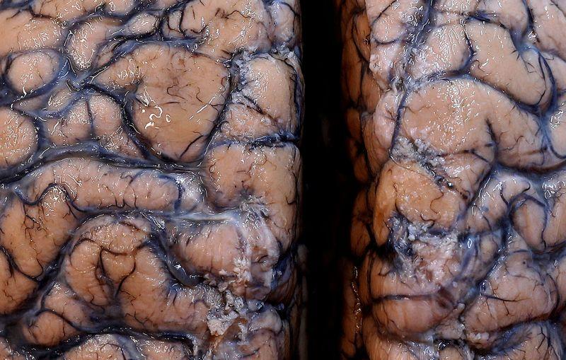 Scientists warn of potential wave of COVID-linked mind wound