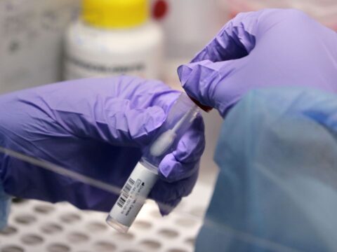 File: New examine present signs of lasting COVID-19 immunity, even after gentle infection