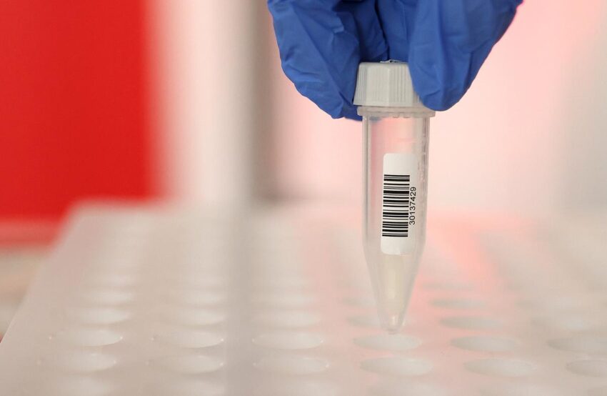 A more cost effective saliva take a look at seeks FDA approval; stroke dangers in youthful patients